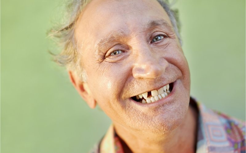 Smiling older man with a missing front tooth